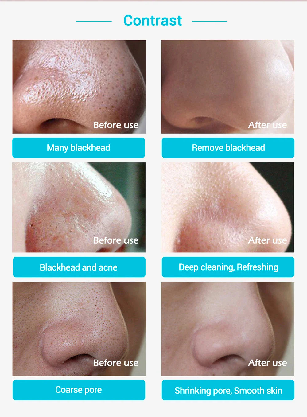 LANBENA New Style Blackhead Remover Nose Mask Pore Strip